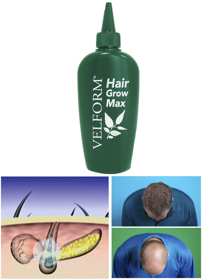 ‘VELFORM Hair Grow Max‘ Haarwater